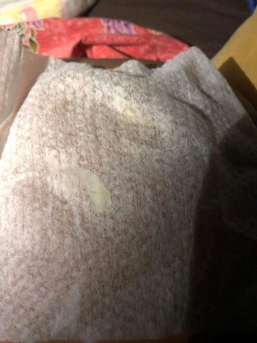 ขอสอบถามแม่ๆหน่อย ในภาพคือตกขาวหรือมูกใส แต่มีอาการปวดท้องหน่อยๆ ไม่ถี่มาก