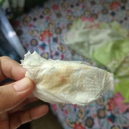 30 weeks Discharge with small blood