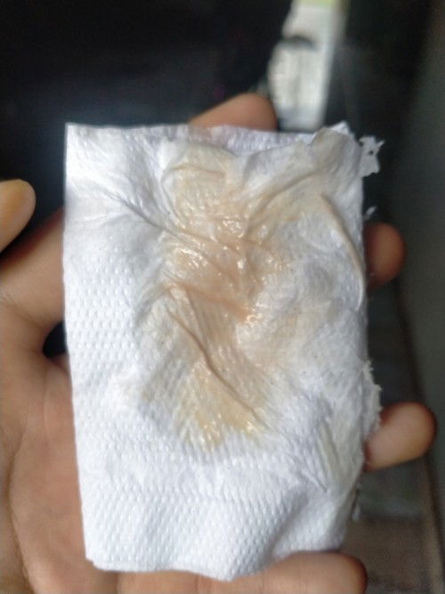 ตกขาวในคนท้อง