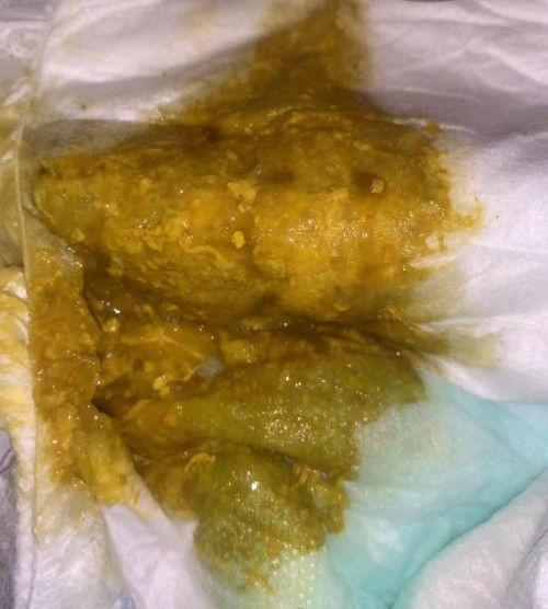 Najis bayi 4bln ada warna coklat seakan darah