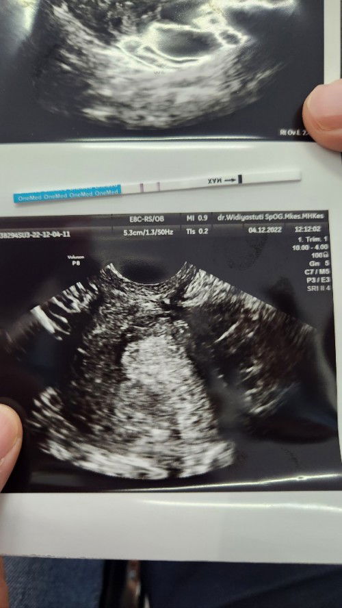 Hamil 4 minggu