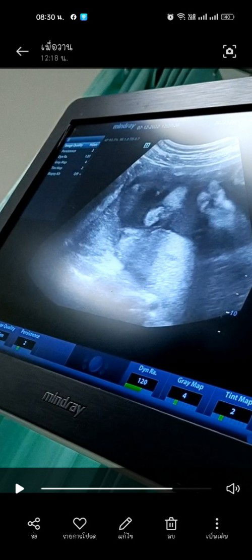 ใบหน้าตอนซาว