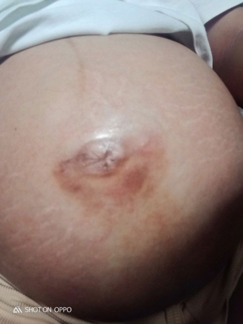 Mga momsh normal lang po ba to?