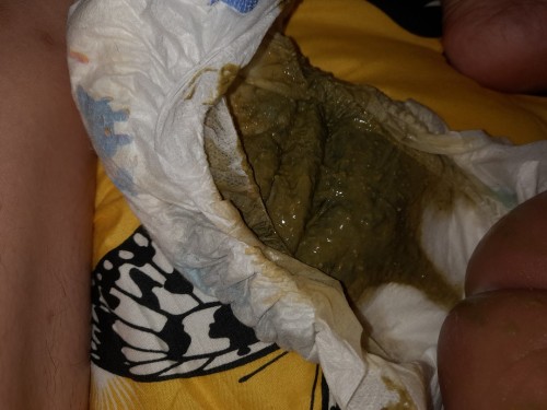 Najis anak saya warna hijau berair. Adakah ia normal. Dia baru umur 3 bulan
