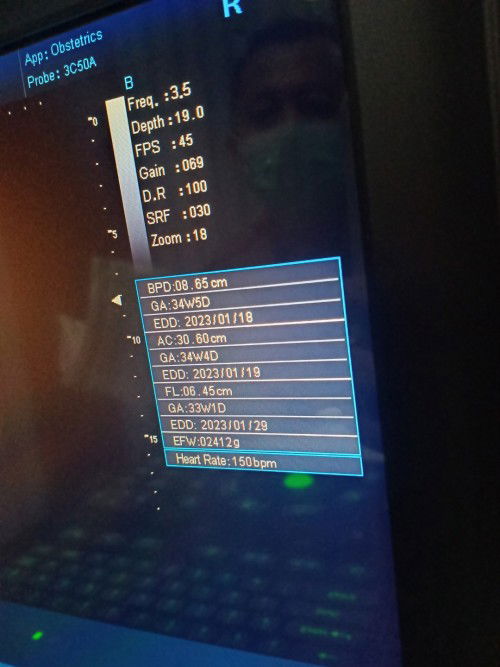 HPL USG pertama 25 desember