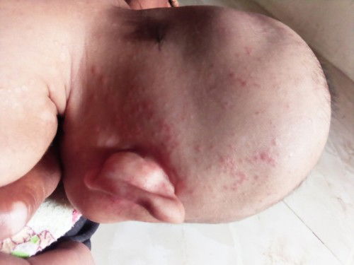 Mending ke dokter anak apa dokter kulit?