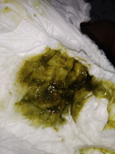 ถ่ายสีเขียวผิดปกติไหม