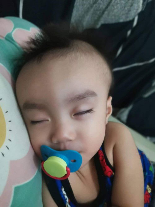 Nabaldog po yung baby ko