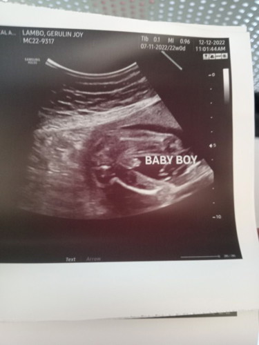 Please help mommies. Is it real, baby boy ba talaga? I am 21 weeks now
Thank you sa mag comment.