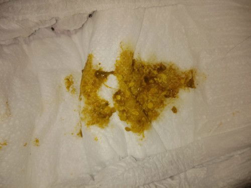 Nag tatae ba ang baby ko or normal lng