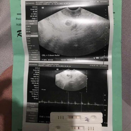 Pregnancy Journey