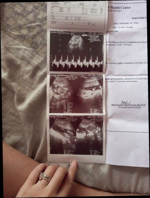 GENDER DETERMINATION