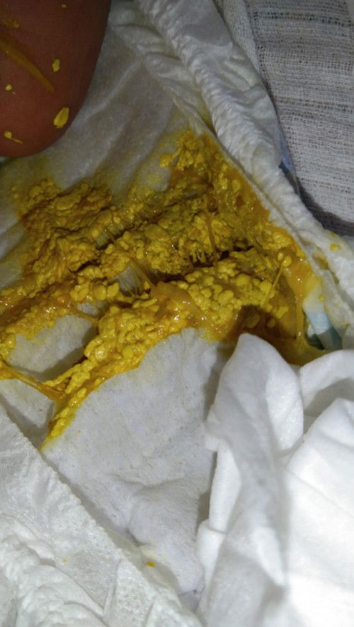 Bahaya tak taik baby mcm ni??