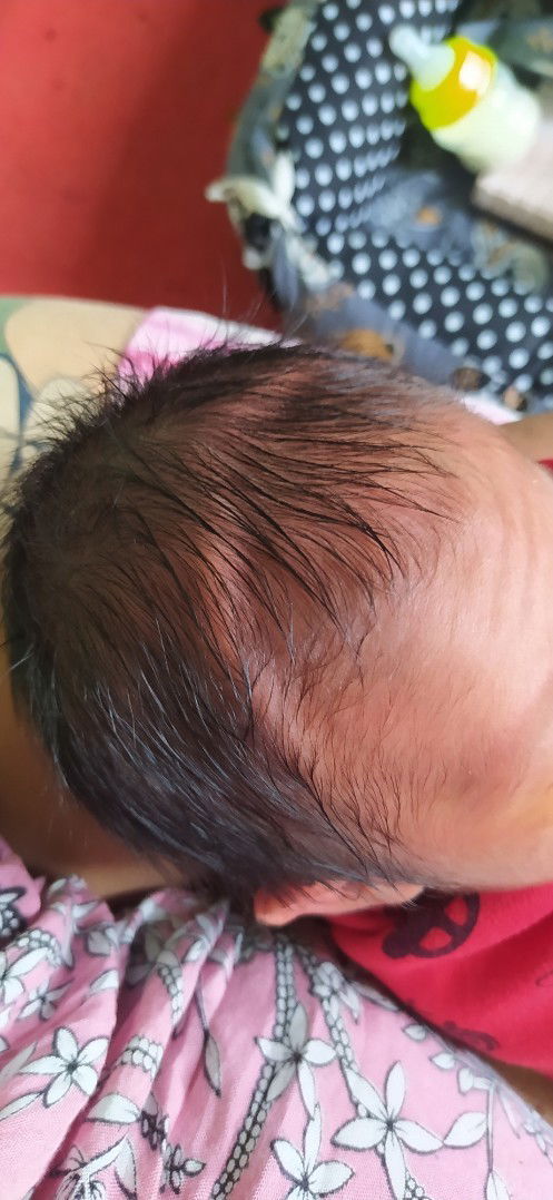 Kepala bayi ada lengkungan