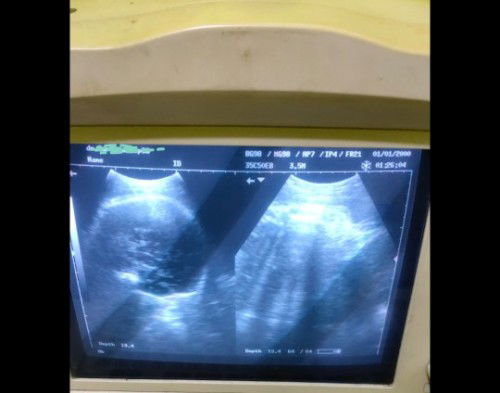 Asalamuallaikum Soree bundaaaa