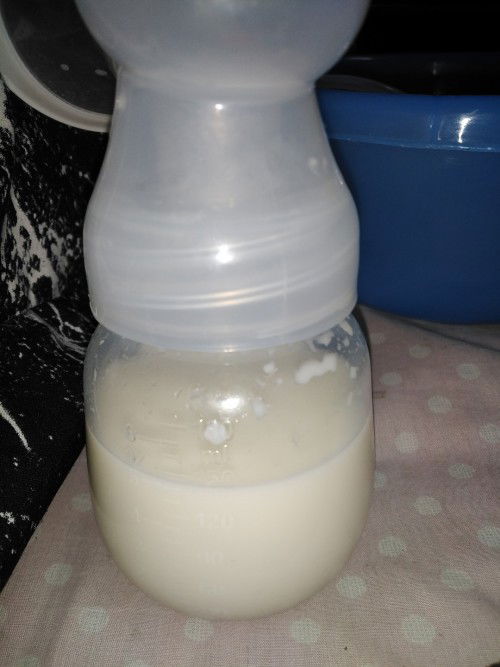 แบบนี้เรียกน้ำนมใสไหมคะ