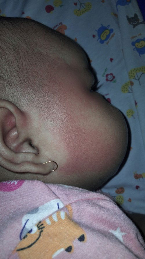 Pipi bayi tbtb merah