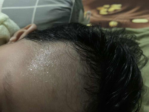 Keringat pada kepala bayi