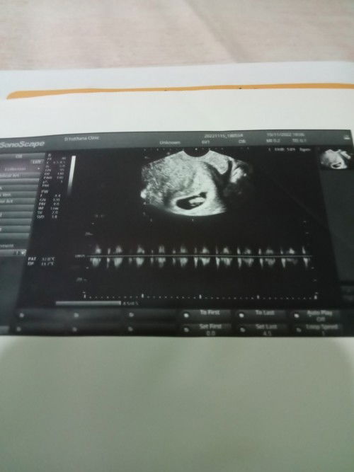 ทำใจไม่ได้เลยค่ะแม่ๆ