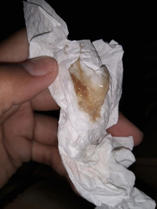 39weeks and 3days❣️ sign of labor?