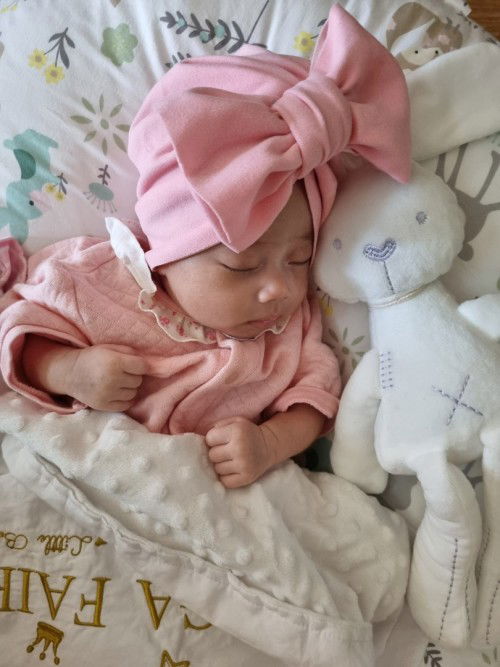 ภาวะซีดในทารก