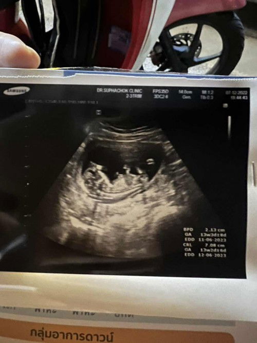 พ่อและแม่เป็นพาหะธารัสซีเมีย !!