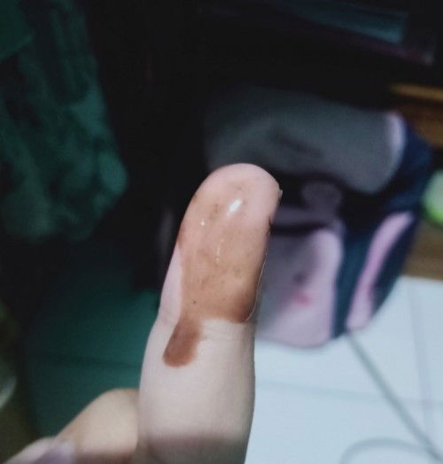 Hari ke 5 flek cklt, stlh ngeflek merah terang di tgl 2-4 berhenti stlh itu tgl 10-skrng flek lg