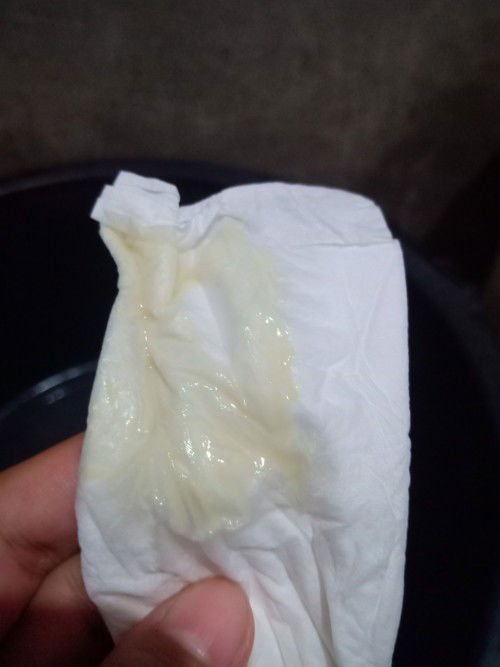 Air ketuban atau keputihan