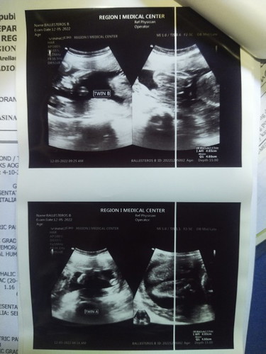 Ultrasound Result