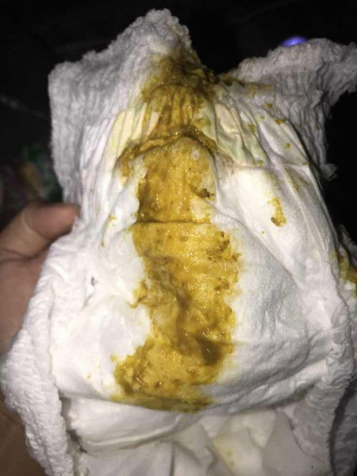 น้องอายุ2เดือนถ่ายเป็นมูก