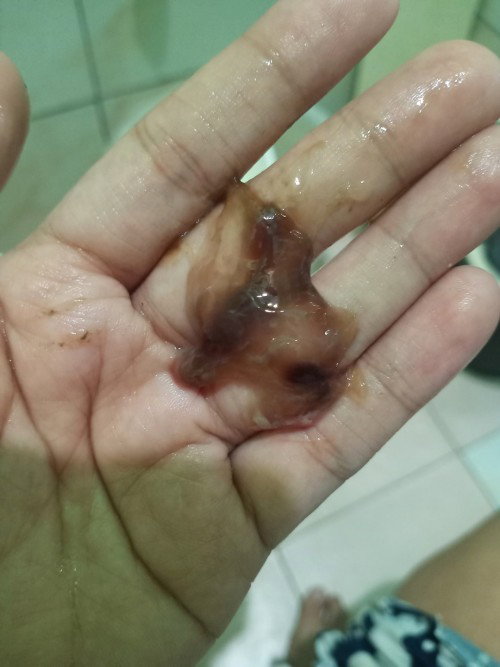 MUCUS PLUG W/ BLOOD | 38w5d