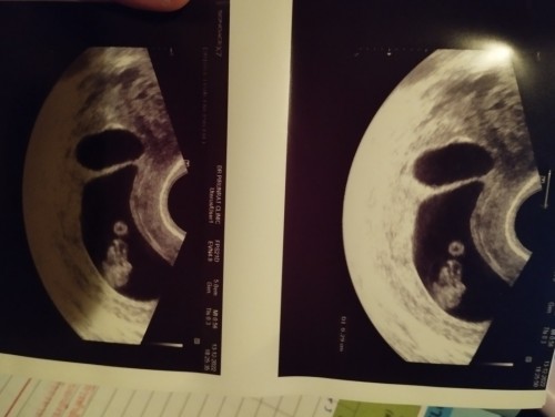 สอบถามภาพการซาวด์คะ