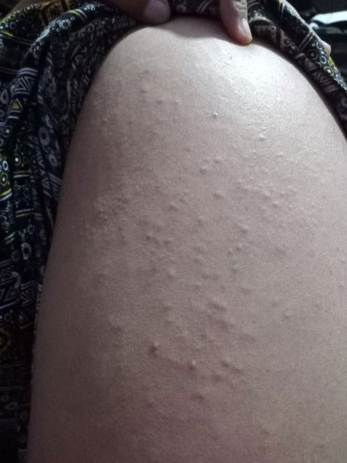 Hamil pertama 14 minggu