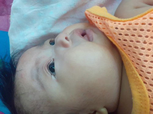 ตาลูกน้อยเจ็บเป็นขี้ตาเหมือนกุ้งยิง