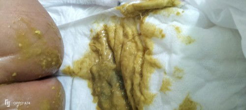 Poop for 2 mons old baby