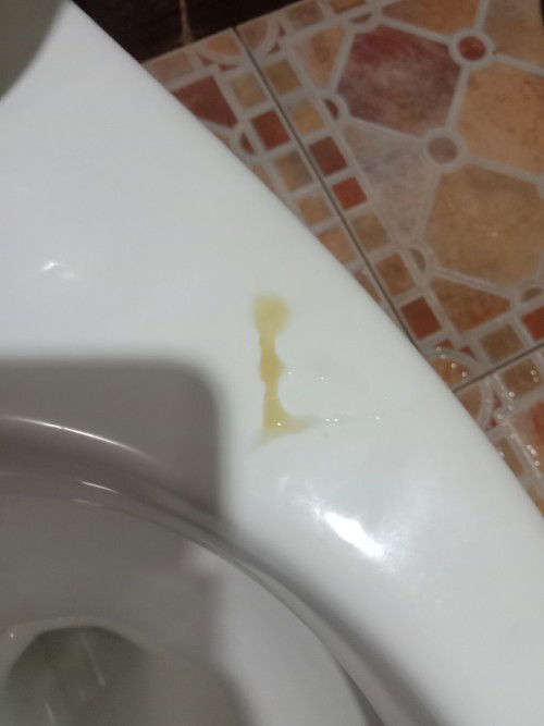 เพิ่งคลอดน้องได้เดือนกับ8วันมันคืออะไรคะ