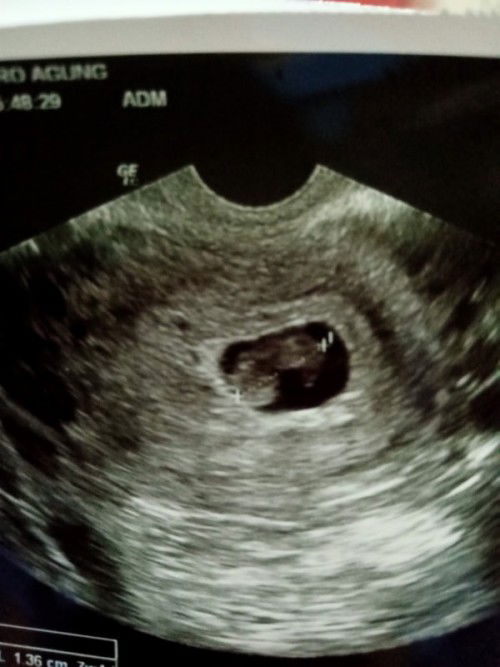 Flek apa keputihan tolong di Jawab y Bun. Saya tanya tidak pernah ada yang respon.