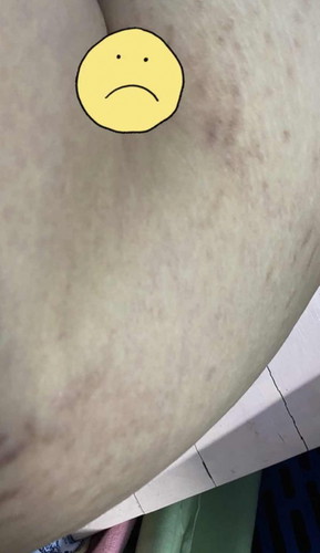 ทีมท้องไม่แตกแต่ตรงอื่นไม่รอด