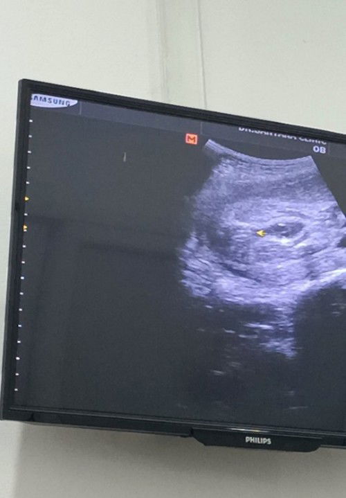 #ทีมกุมภาพันธ์