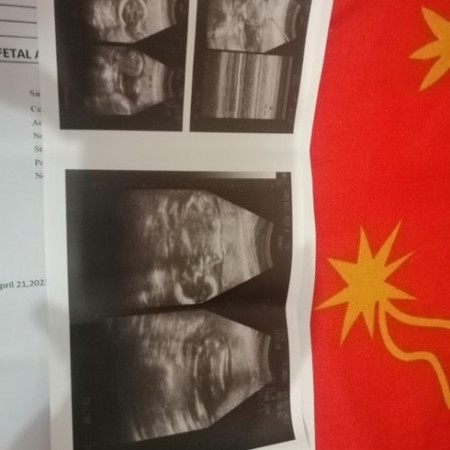 20 weeks and 1 day Gender