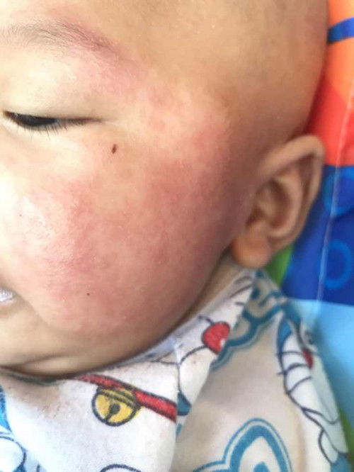 สอบถามเเม่ๆหน่อยค่ะ