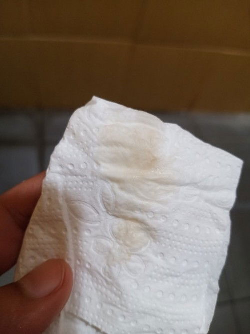 ตกขาวสีน้ำตาล