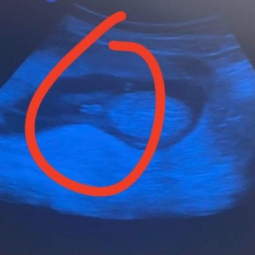Boy or Girl