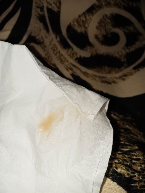 Flek usia kehamilan 9minggu