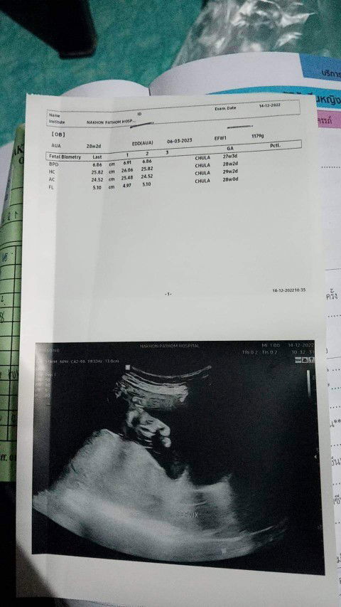 ผู้หญิงหรือผู้ชายค่ะแบบนี้