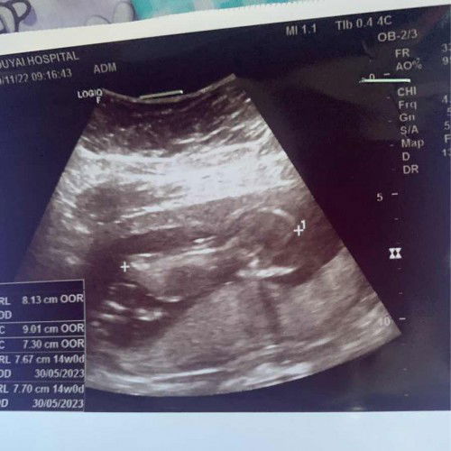 แม่ๆคะขอสอบถามหน่อยค่ะภาพนี้ใช่น้องนอนคว่ำมั๊ยคะภานี้ตอน3เดือนกว่าๆคาะตอนนี้แม่4เดือนแล้วเราจะทราบเพศน้องตอนไหนคะ