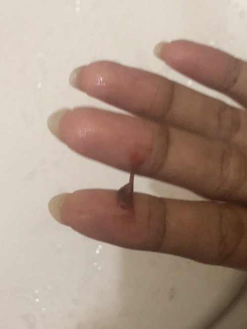 normal ga si diusia 12week