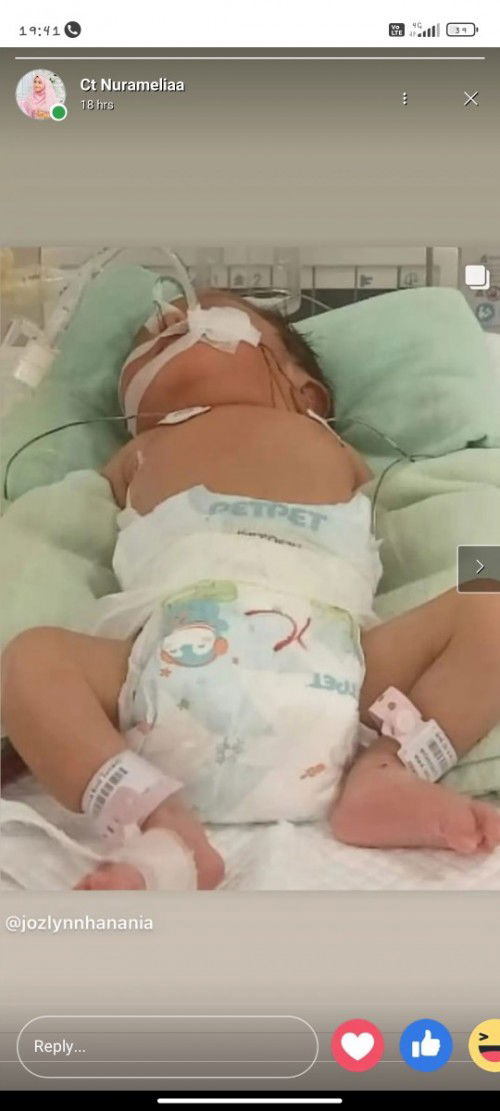 sedekah kos rawatan baby