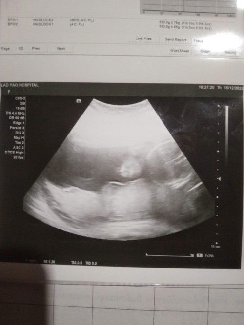 ช่วยดูผลอัตราซาดว์ของเราหน่อยค่ะ