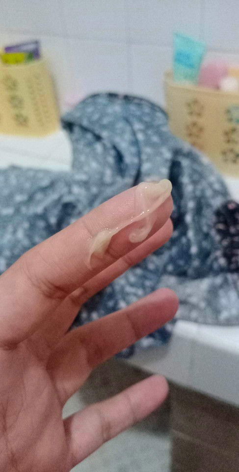 Ito na po ba yung mucus plug?